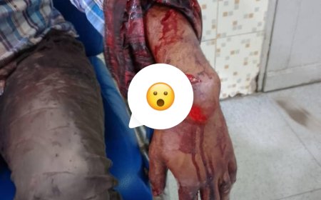 Insécurité croissante à Kinshasa : un autre professeur de l'UNIKIN violemment agressé