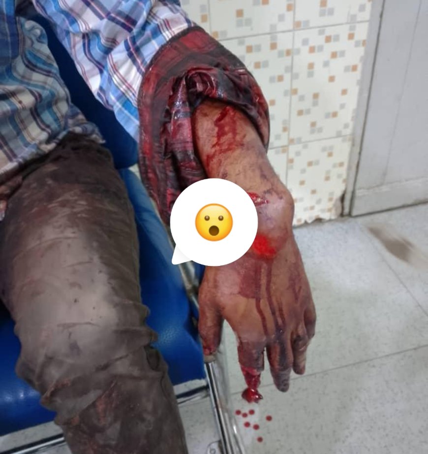 Insécurité croissante à Kinshasa : un autre professeur de l'UNIKIN violemment agressé