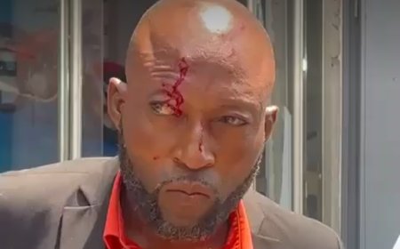 RDC-Kinshasa : des conseillers communaux agressés lors d'un sit-in pour réclamer deux ans arriérés de salaire