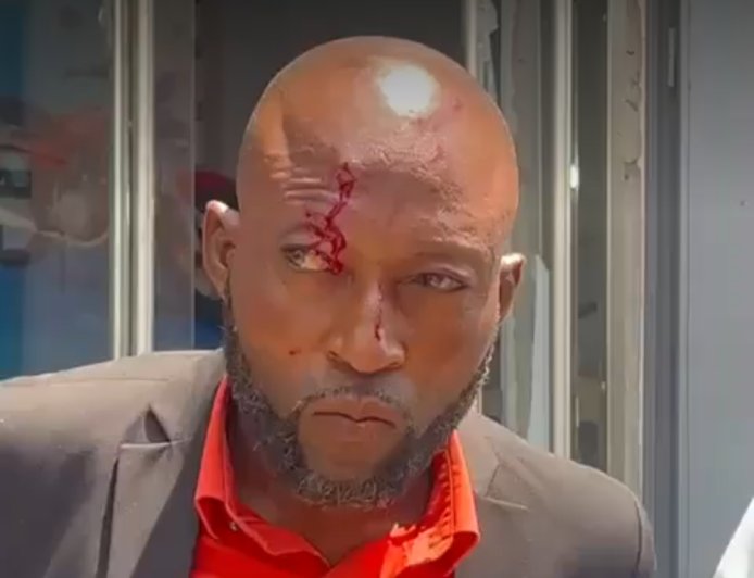 RDC-Kinshasa : des conseillers communaux agressés lors d'un sit-in pour réclamer deux ans arriérés d'émoluments