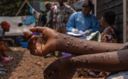 Kongo-Central : après 11 décès dus au choléra, Guillaume Ngefa suspend les admissions à la prison de Mbanza-Ngungu