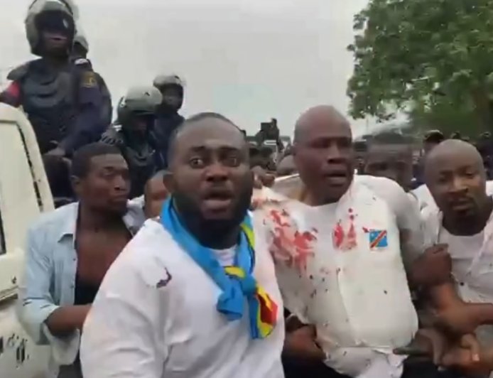 Sit-in réprimé de l'opposition : blessés, gazés, et deux morts selon Martin Fayulu