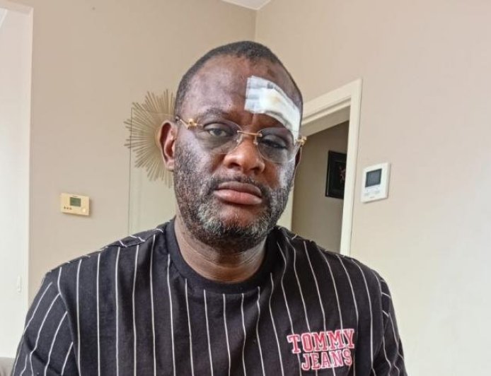 Belgique : le journaliste Claude Pero Luwara à nouveau agressé à Tirlemont