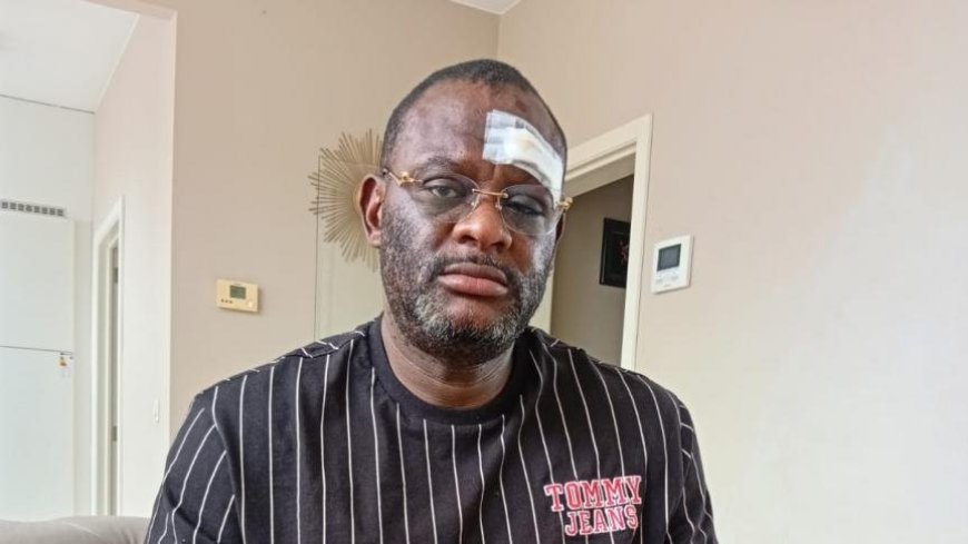 Belgique : le journaliste Claude Pero Luwara à nouveau agressé à Tirlemont